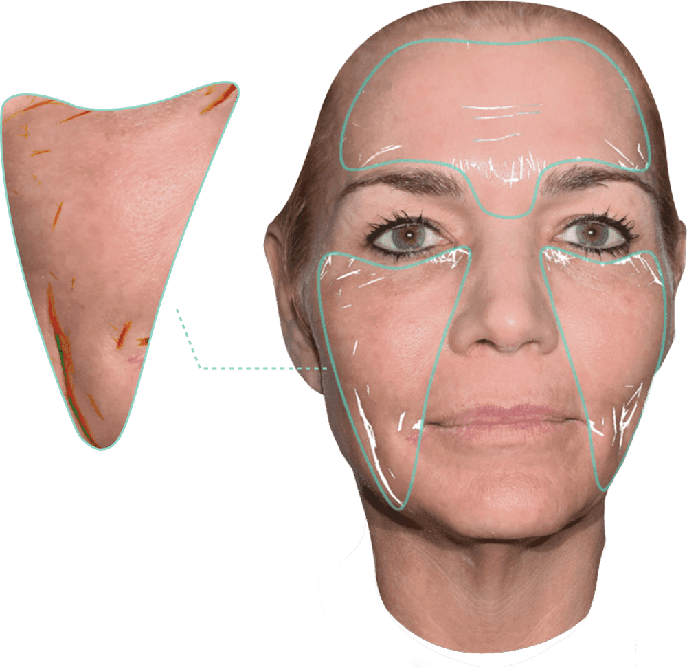 LifeViz® Neo